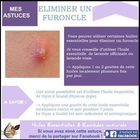 comment soigner un furoncle fessier|Furoncle fessier : comment le soigner